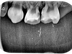 -天使口腔门诊部(上海店)