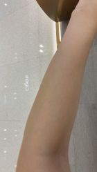 体验后-美莱医学美容医院