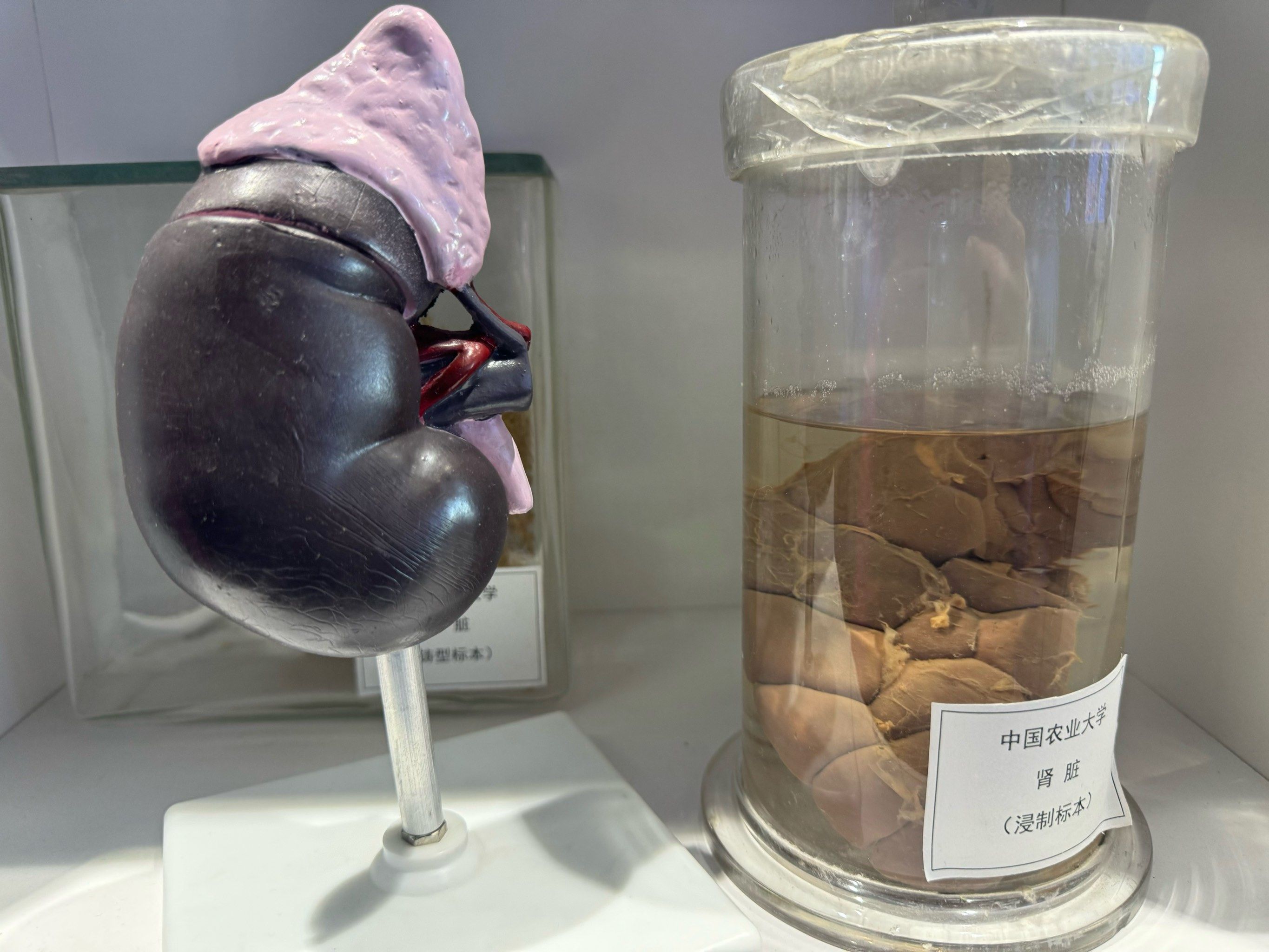 玻璃展柜中,各类人体器官标本在灯光下静静陈列,它们仿佛在无声诉说着