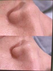 -SKIN79皮肤管理中心