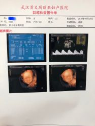 -玛丽亚妇产医院
