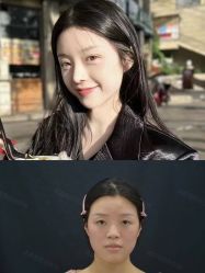 -成都西区医院整形美容