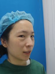 -天津健丽·去眼袋医疗美容机构