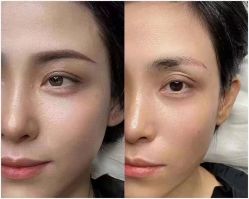 -莲姿娜·半永久纹眉皮肤管理