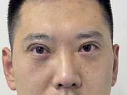 -天津健丽·去眼袋医疗美容机构