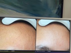 -苑苑vbeauty科技美容SPA