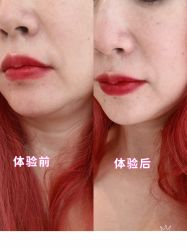 -纯粹医美