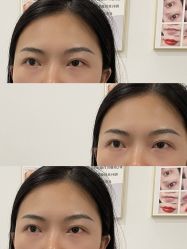 点击看大图 -杨益美学·野生眉半永久纹眉发际线