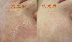-Cream88颜皮肤管理中心