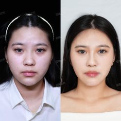 -上海玫瑰医疗美容医院