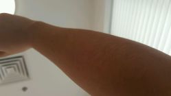 点击看大图 -咪咪比基尼脱毛专业店