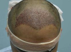 体验后-厦门美莱整形美容医院