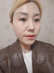 体验后-青岛诺德医学美容医院