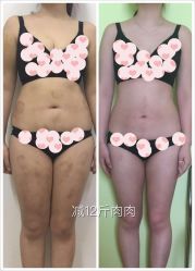 -摩瘦纤体订制减肥