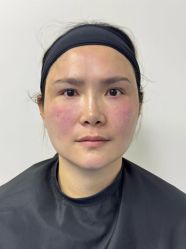 -广州健丽·去眼袋医疗美容机构