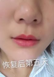 -MIVI半永久纹眉机器野生眉纹唇