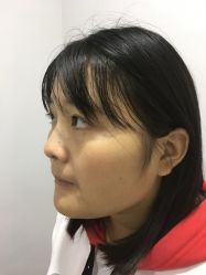 点击看大图 体验前-北京炫美医疗美容