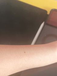 点击看大图 体验前-北京爱育华医院-医疗美容科