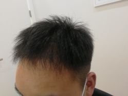 -雍禾植发全国连锁