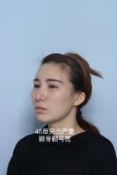 点击看大图 -四川娇点医学美容医院