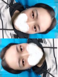 -西施无菌半永久纹绣眉眼影唇轻增发纹发际线