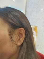 -长沙雅美医疗美容医院