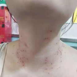 -北京美痣堂古方祛痣斑疣瘊