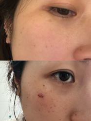 体验前-Dr.U博士医疗美容医院