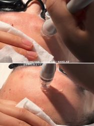 点击看大图 -韩国淼美颜皮肤管理官方直营店