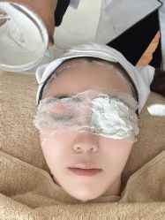 -苗坊净颜草本痘肌护肤