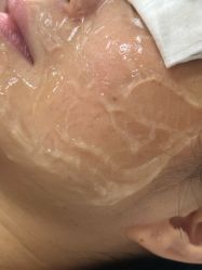 -长沙雅美医疗美容医院