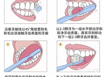适用成年人的口腔清洁方法