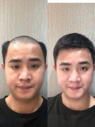 -发饰美男士增发补发假发定制店