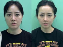 -Yestar 嘉兴艺星医疗美容医院