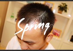 点击看大图 体验后-大麦微针植发全国连锁