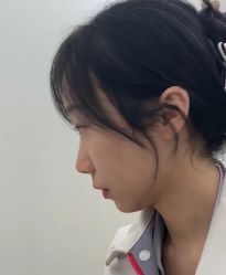 体验前-深圳美莱医疗美容医院