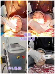 -More摩尔医美の注射线雕光电中心