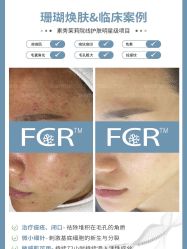 -苗方清颜痘肌研究所