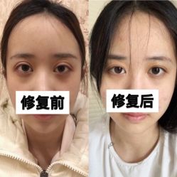 -上海漾颜医疗美容