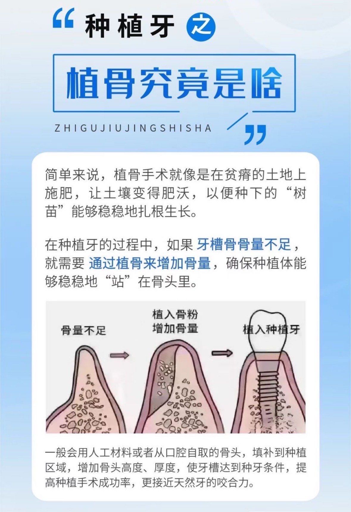 种植牙之"植骨究竟是啥"
简单来说