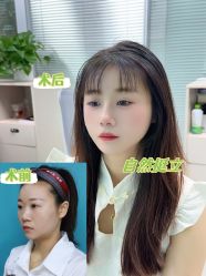 -深圳艺星医疗美容医院