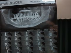 -西京医院