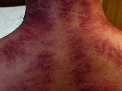 -天然沐足·推背采耳·敷姜艾灸(龙眼美食街店)