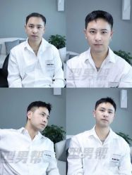 -型男帮男士假发补发·佩戴式发型