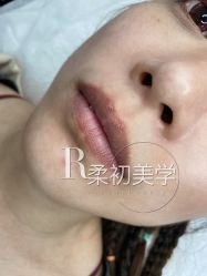 -RC半永久纹眉纹发际线