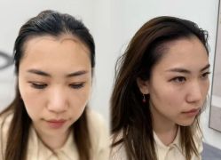 -西施无菌半永久纹绣眉眼影唇轻增发纹发际线