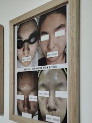 -美肤盾祛痘·问题肌头疗管理中心