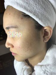 -皇族养心堂·净痘·修敏·御颜