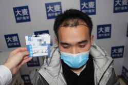 体验前-大麦微针植发丨全国连锁