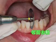 -团圆口腔·种植中心(锦江院区)